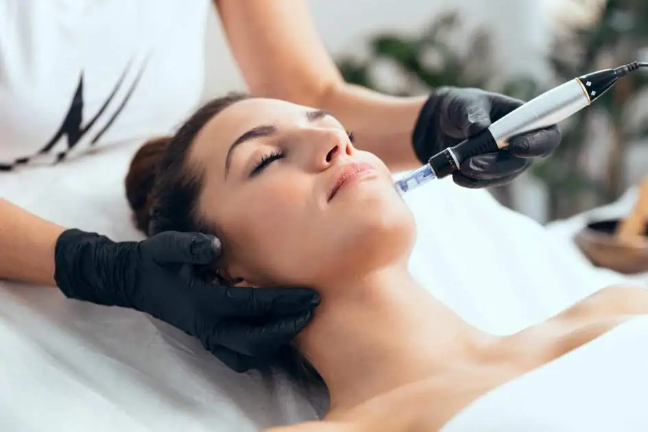 Microneedling Treatment in Savannah, GA | Inject Savannah