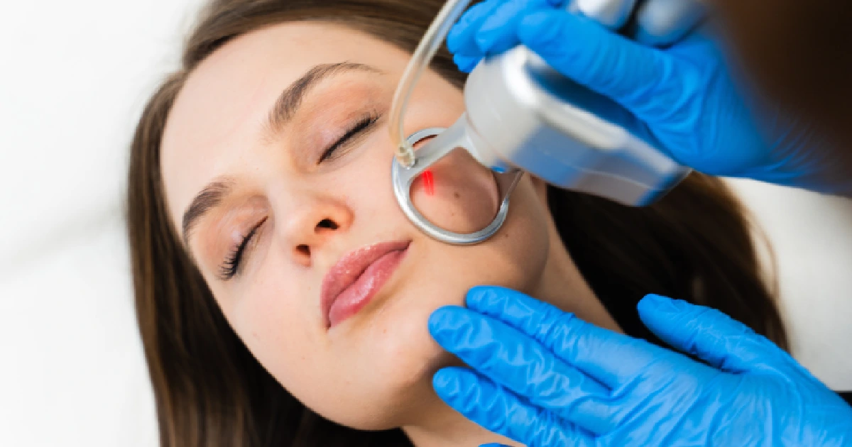 Women Receiving Cool Peel Treatment in Savannah, GA