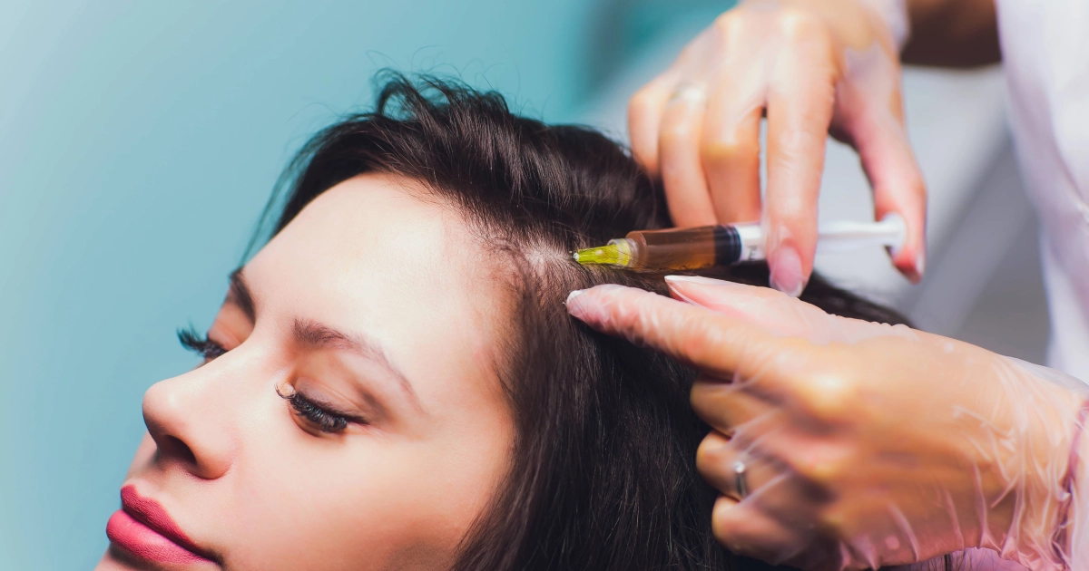 A gloved medical professional administers a scalp injection for PRP therapy treatment in Savannah, GA.